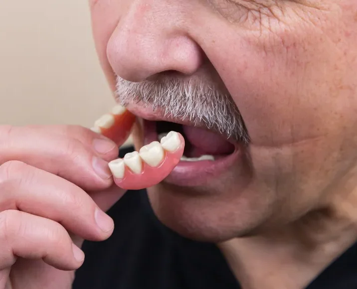 Dr André Okamoto - Implantes Dentários - Dentes Fixos - Prótese Protocolo - Dentadura Fixa - Moóca e Região